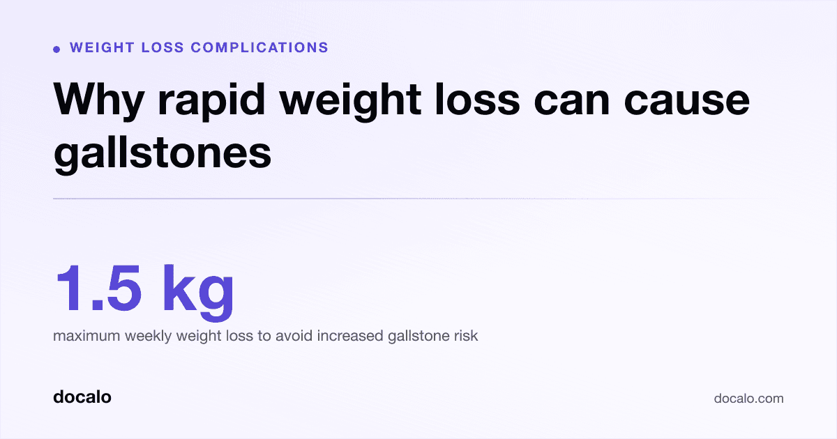Docalo article card, Weight loss complications: “Why rapid weight loss can cause gallstones”. 1.5 kg maximum weekly weight loss to avoid increased gallstone risk.