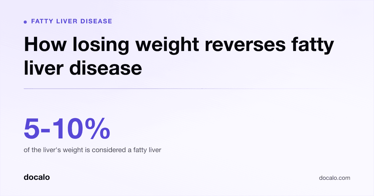 Docalo article card, Fatty liver disease: “How losing weight reverses fatty liver disease”. 5-10% of the liver's weight is considered a fatty liver.